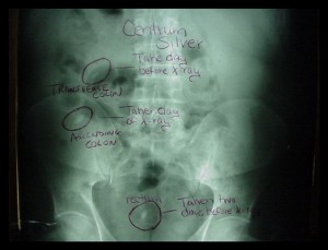 Xray Vitamin Stomach